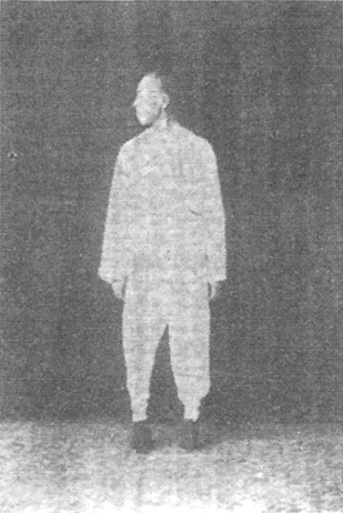 Dix-huitième figure : la tête tournée jusqu’à l’épaule droite (édition de 1930)