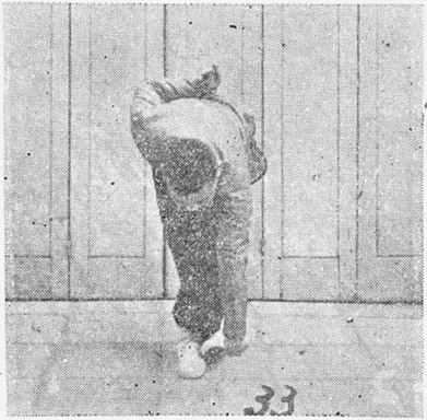 Figure 33 : la main droite descendue en crochet