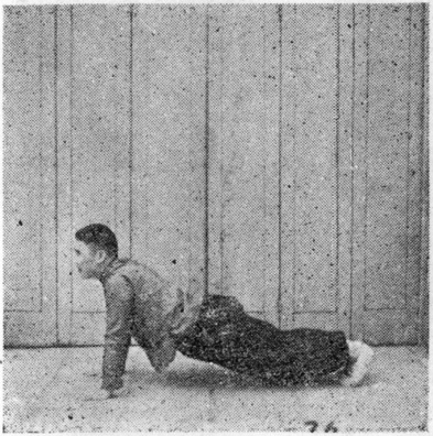 Figure 74 : le corps soulevé par la force des bras